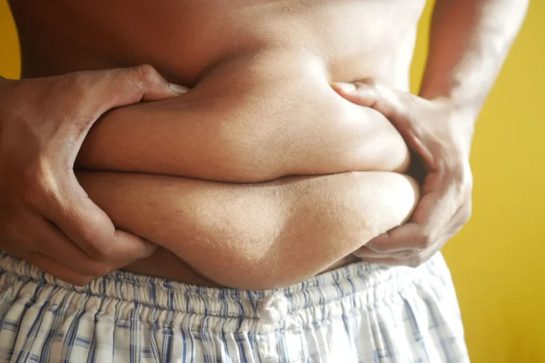 Body Fat Percentage – body fat percentage chart for men and women by age